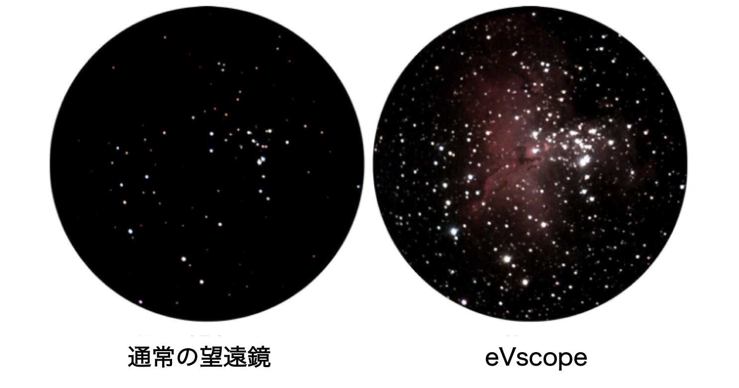 eVscope
